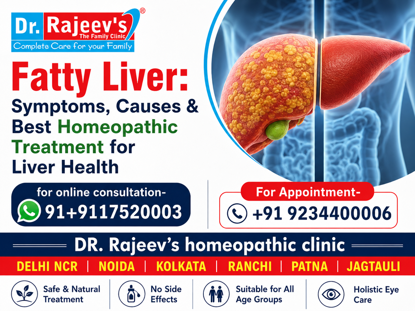 Fatty Liver: Symptoms, Causes & Best Homeopathic Treatment for Liver Health