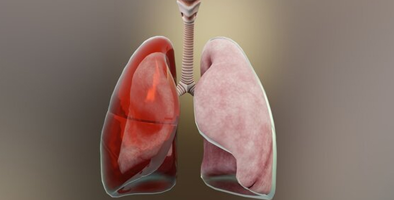 POSSIBLE OF HAEMOTHORAX IN HOMEOPATHY