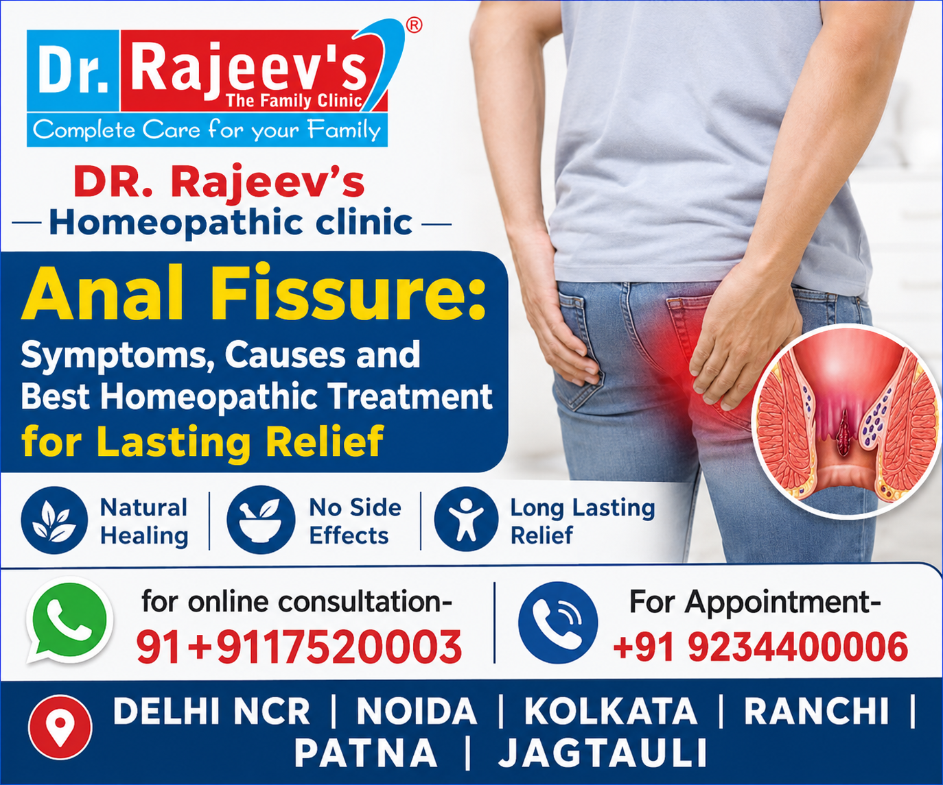 Anal Fissure: Symptoms, Causes and Best Homeopathic Treatment for Lasting Relief