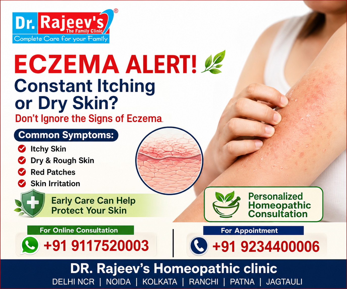 Eczema: Symptoms, Causes  Homeopathic Treatment for Healthy Skin