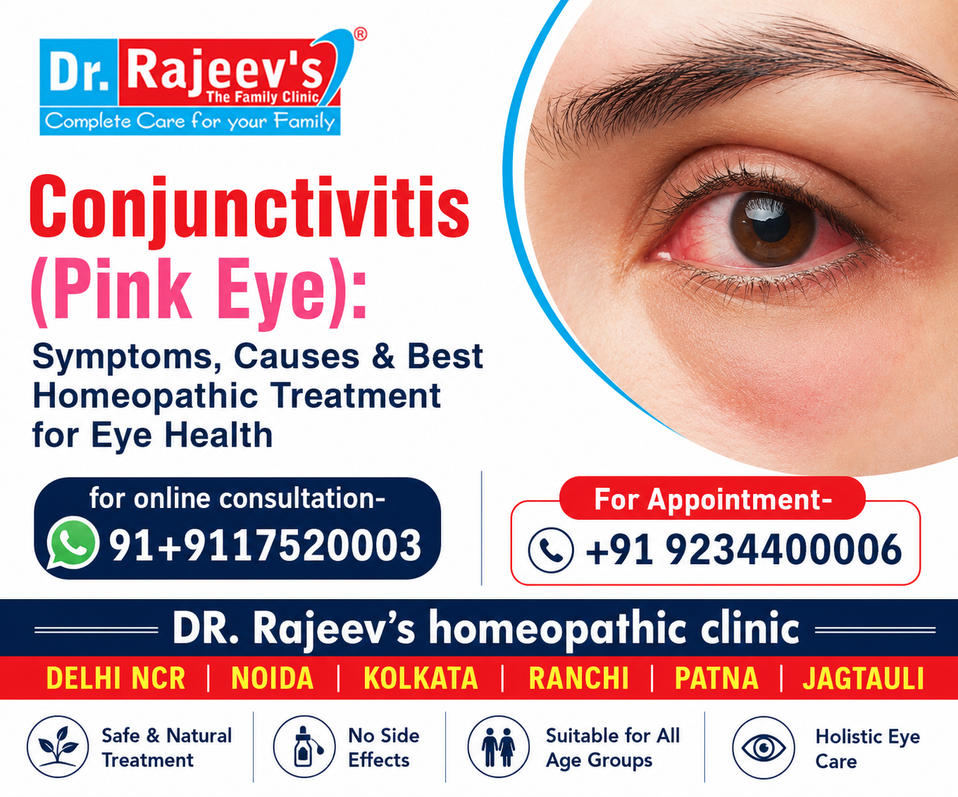 Conjunctivitis (Pink Eye): Symptoms, Causes & Best Homeopathic Treatment for Eye Health