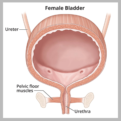 What Does Burning or Painful Urination (Dysuria) Mean?