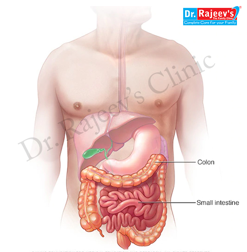 Intestinal colic hot sale