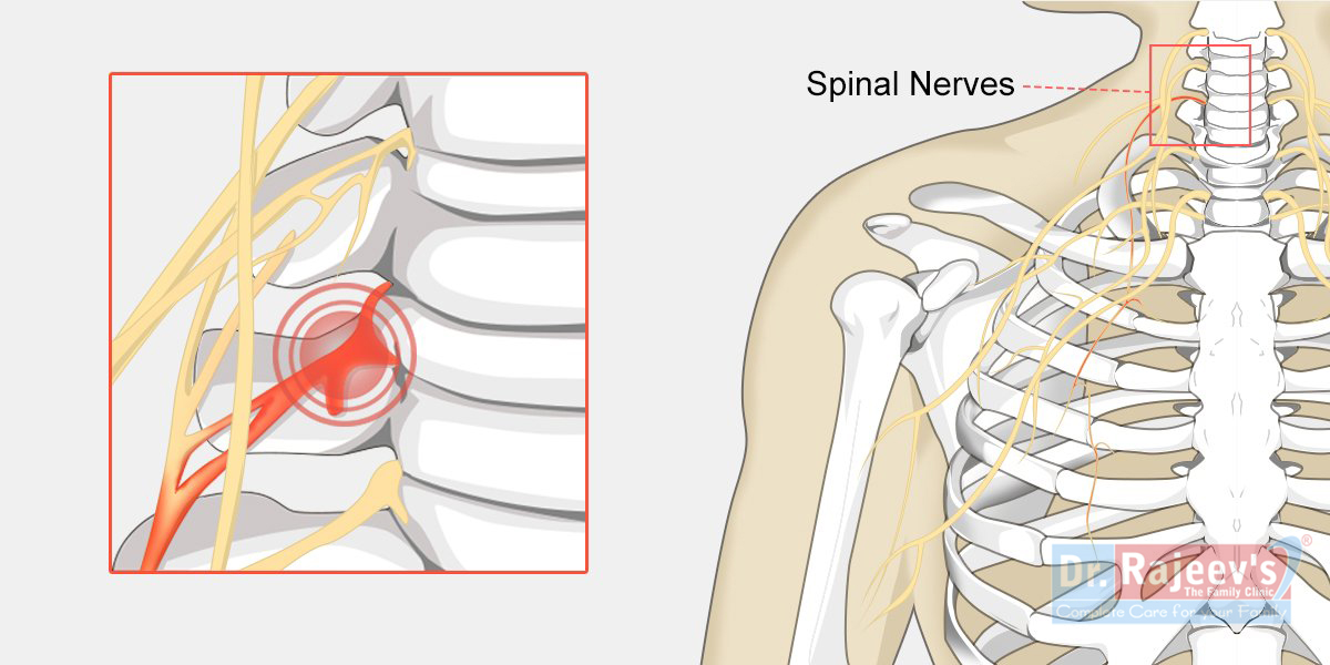 tumor on spine symptoms