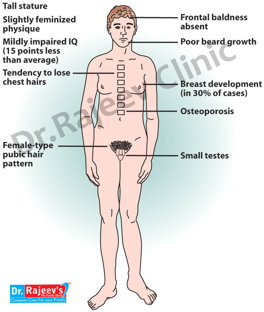 xxyy syndrome